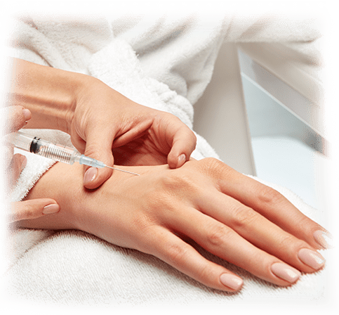 Botulinum Injection For Sweaty Hands