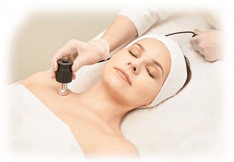 RF Micro Needling